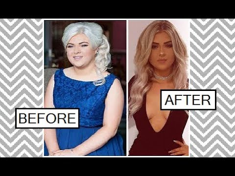 Amazing Weight Loss Transformations