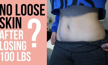 LOOSE SKIN AFTER 100 LBS WEIGHT LOSS – How to avoid lose skin
