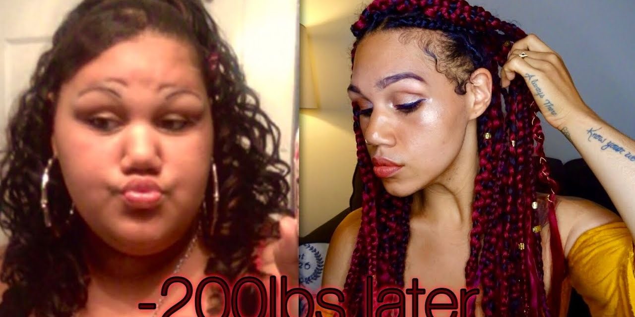 FACIAL CHANGES after EXTREME Weight Loss